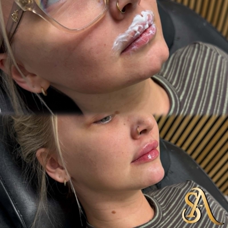 image-11